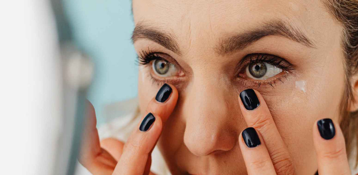 causes of dark circles